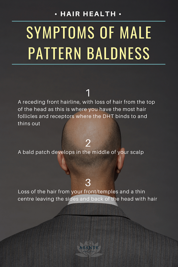 symptoms of male pattern baldness